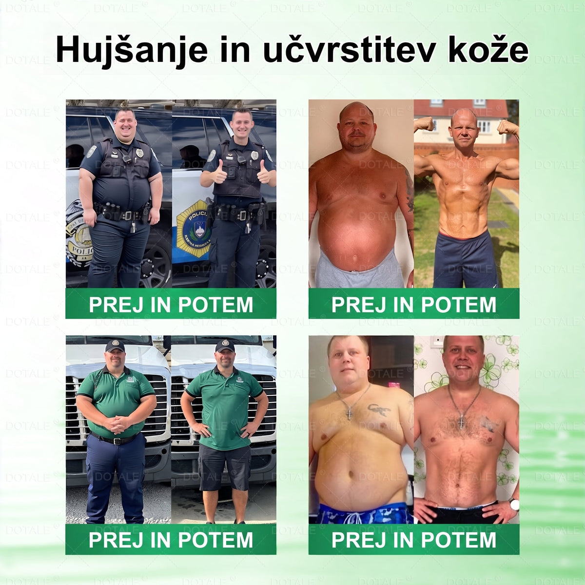 𝑫𝑶𝑻𝑨𝑳𝑬® Presnovni nanomikroiglični obliž (Samo enkrat na dan, vidne spremembe v 7 dneh)