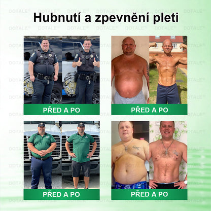 Poslední šance! Nenechte si ujít tuto příležitost se slevou 50 %! | 𝑫𝑶𝑻𝑨𝑳𝑬® Metabolická Nano Mikroneedlová Náplast